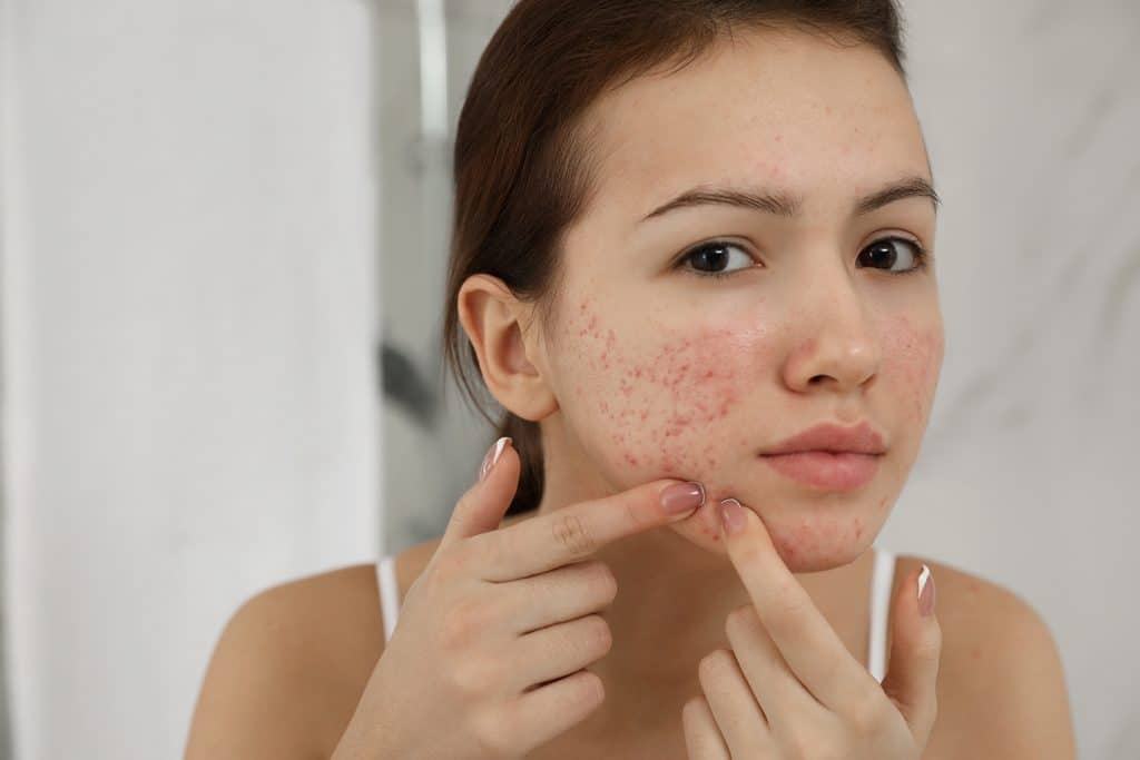 Expert Tips For Establishing a Good Skincare Routine for your Teenager