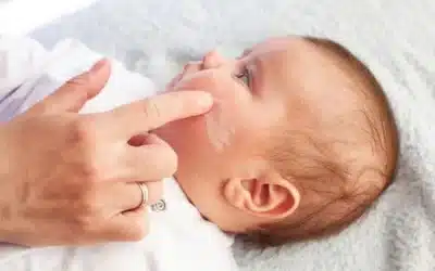 What is Baby Eczema?